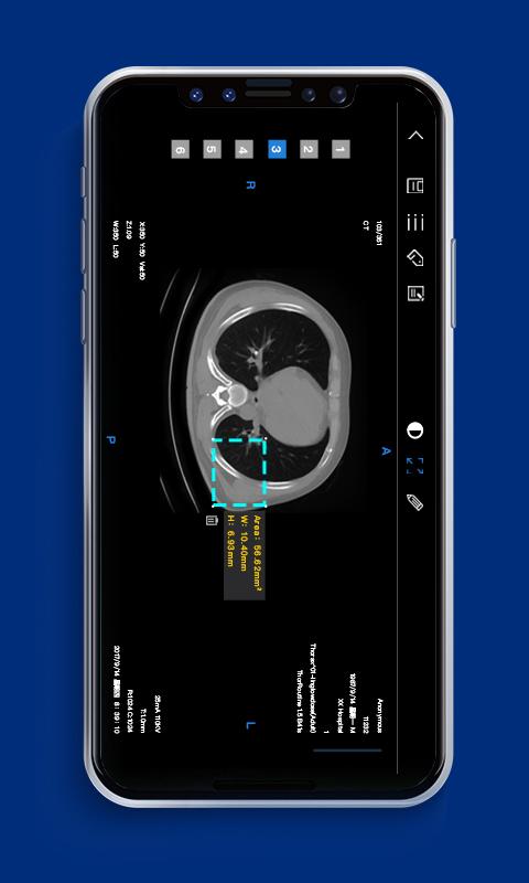 Dicomlabel医疗影像云标注平台App截图3